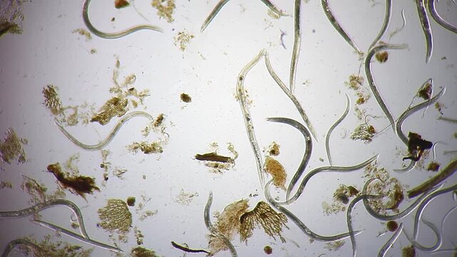 Nematode roundworms colony moving among organic particles in water sample, microscopic view at 40x magnification, brightfield