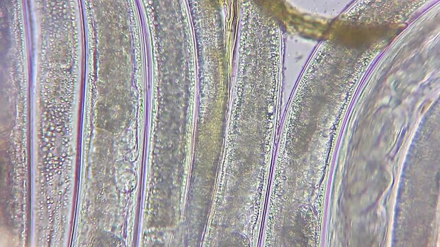 Extreme close-up of nematode roundworms packed together, detailed internal cell structure and cuticle under 400x magnification, brightfield