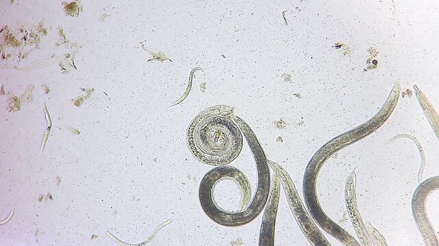 Nematode roundworms moving in water with one individual curled in a spiral, microscopic brightfield view at 100x magnification