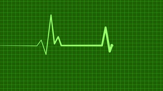 Cardiology Monitor Animation Featuring Heart Rate Wave Signal