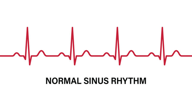 A continuous red line depicts a normal sinus rhythm displayed as a medical electrocardiogram heart health diagnostic signal graphic