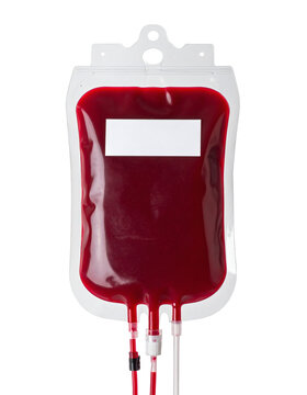 This photograph shows a medical blood bag filled with dark red liquid, ready for transfusion or laboratory use, with tubing attached and a blank label area for identification.