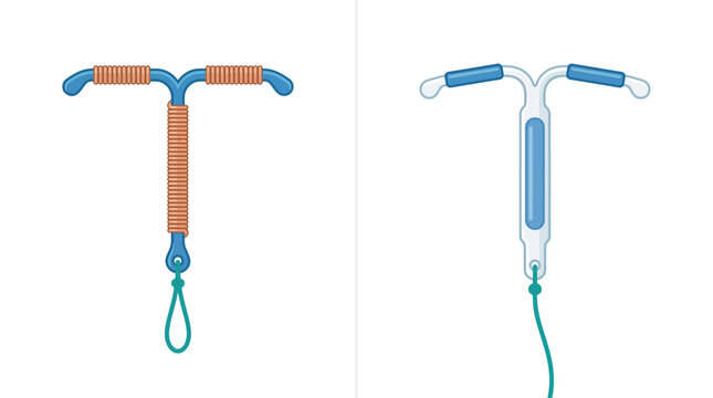 Intrauterine device vector illustration for birth control and reproductive health