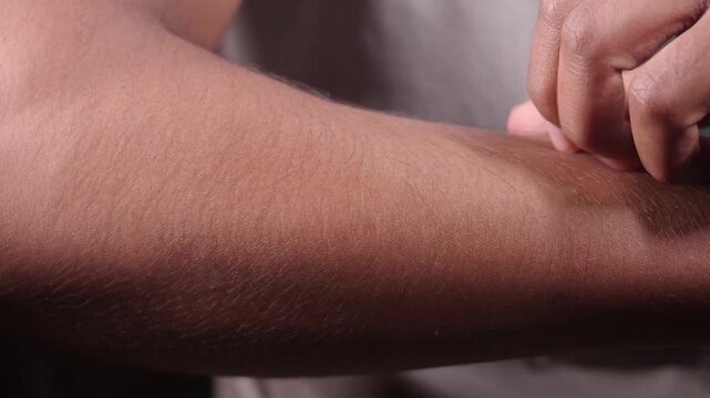 Close-up of hand scratching itchy arm with fingers in slow motion