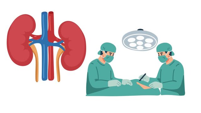 Animation of kidney surgery medical procedure