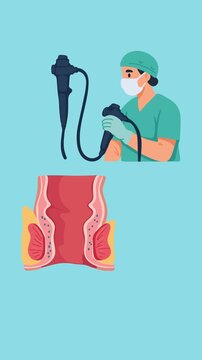 Animation of endoscopic examination of the rectum and hemorrhoids