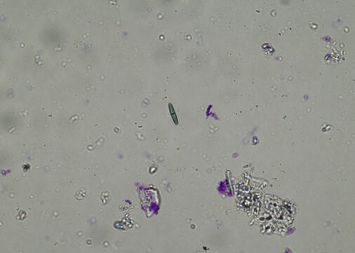 soil microorganisms under a microscope including amoeba, flagellates, nematodes, fungi, bacteria	