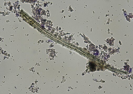 soil microorganisms under a microscope including amoeba, flagellates, nematodes, fungi, bacteria	