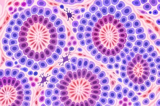 Embryonal tumor with multilayered rosettes medical illustration showing malignant cellular histology architecture and primitive neuroectodermal cell clusters