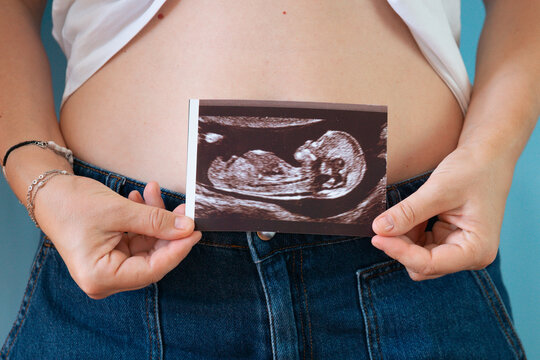 pregnant woman holding ultrasound photo against belly in blue jeans closeup, concept of family, motherhood, prenatal care