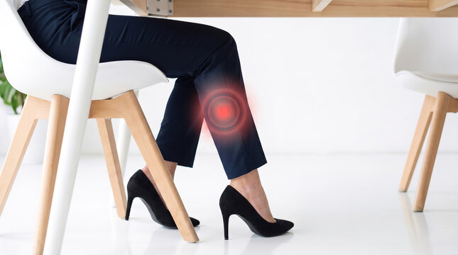 Female legs with high heels in office showing varicose veins and calf pain, medical visualization with copy space foк text