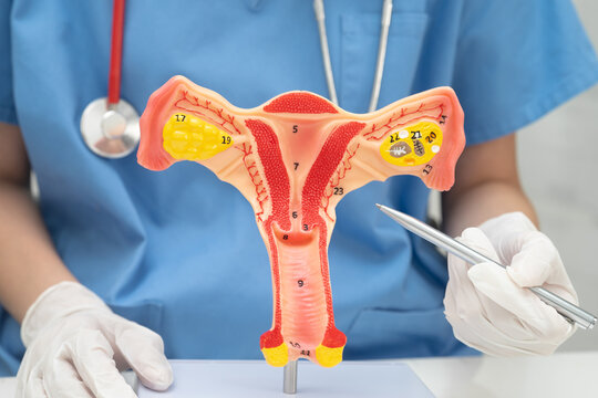 Doctor holding human uterus model for vaginal and cervix pap smear check up in the obstetrics and gynecology.