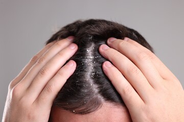 Fototapeta premium Dandruff problem. Man examining his head on grey background, closeup