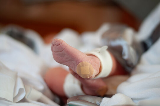 Newborn baby foot with bandage and hospital band