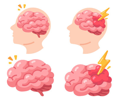 Understanding brain pain a visual journey from slight headaches to severe neurological distress.