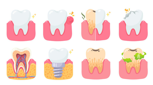 Visual Guide to Dental Health Understanding Tooth Problems, Treatments, and Oral Care Stages