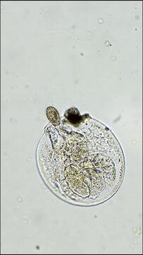 Bacteria Feeding on Dead Rotifers Under Microscope