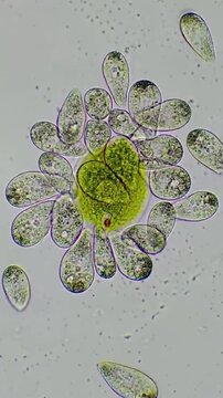 Ciliates Gathered Around Phacus Under Microscope