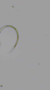 Resting Egg of Rotifer Under Darkfield Microscope