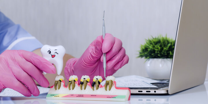 Pediatric dentistry concept showing a doctor holding a happy tooth mascot while explaining the stages of periodontitis and gum disease.