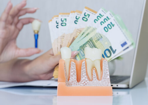 Paying for expensive stomatology services. Female patient holding euro money bills and single dental implant near office laptop.