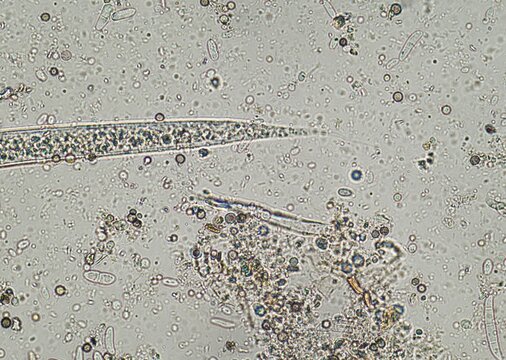 soil microorganisms under a microscope including amoeba, flagellates, nematodes, fungi, bacteria	