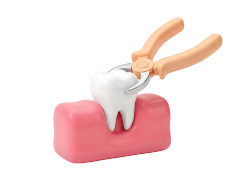 Dental pliers pulling a white tooth from pink gums for a dental procedure illustration isolated on transparent background