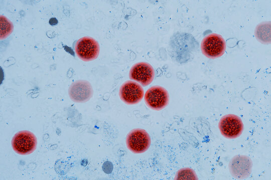 Microscopic view of Cyclospora cayetanensis oocysts under magnification, stained bright red. cyclosporiasis outbreak, foodborne parasites, intestinal infections. water pollution, concept idea