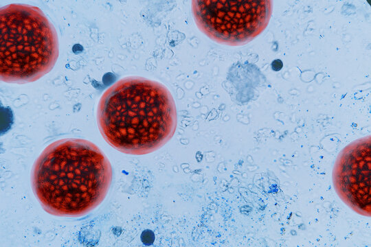 Close-up microscopic view of Cyclospora cayetanensis oocysts stained bright red. medical topics like cyclosporiasis outbreak, foodborne parasite infection, microbiology research. water pollution