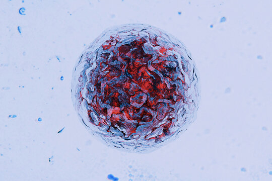 High-resolution medical illustration of a complex spherical waterborne parasite egg, textured red core and a protective crystalline outer layer, suspended in a contaminated liquid with other pathogens