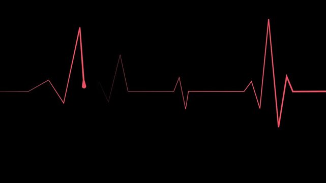 Heartbeat lines electrocardiogram style pulse with sharp spikes and flat sections animation