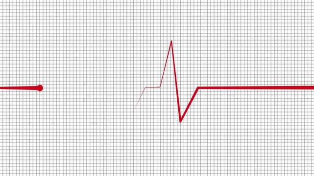Heartbeat line wave signal showing a medical pulse pattern isolated animation