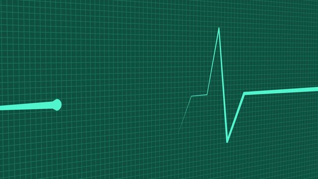 Heartbeat line wave signal showing a medical pulse pattern isolated animation