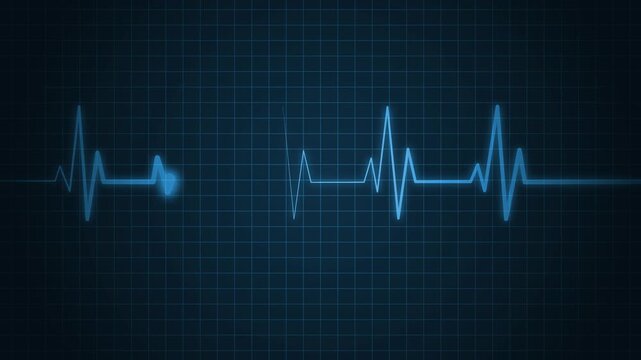 Electrocardiogram line heartbeat rhythm and medical monitor trace animation