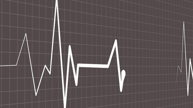 Heartbeat line showing an irregular electrocardiogram style signal, medical concept for health animation