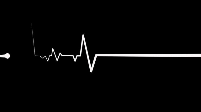Heart beat line on graph paper showing an ecg pattern and medical signal animation