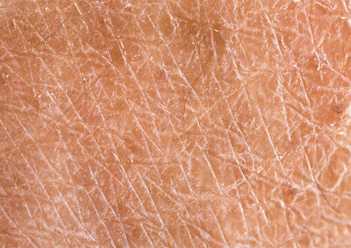 Dry skin texture extreme close up showing dehydrated human epidermis for dermatology medical research and cosmetic skincare product