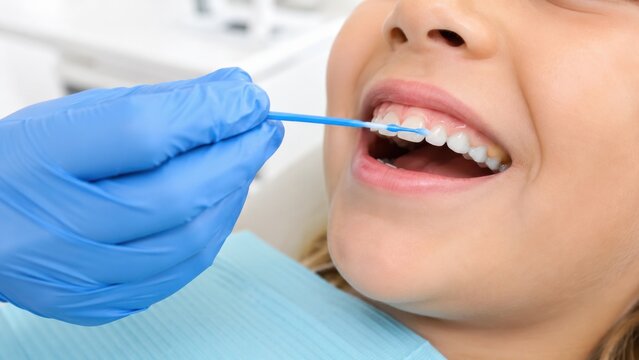 Dentist applying fluoride varnish to child's teeth