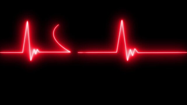 Neon ecg heartbeat line animation on black background