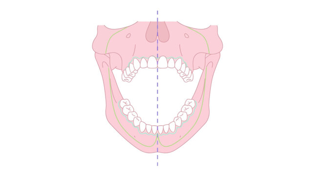 Dental Jaw Symmetry and Midline Alignment Assessment Diagram