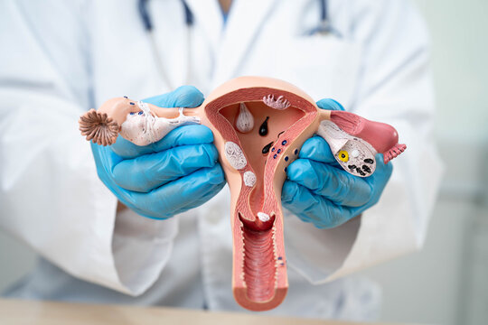 Uterus, doctor holding human anatomy model for study diagnosis and treatment in hospital.