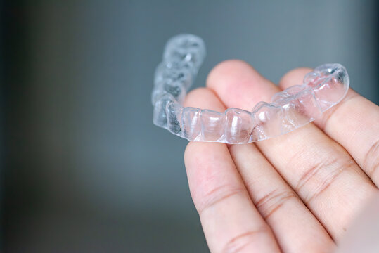  clear aligners device in the mouth on a white background. (invisalign)
