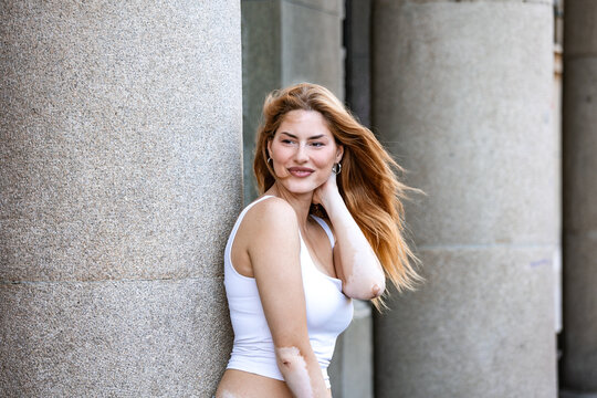 Portrait of a smiling young woman with vitiligo leaning against a concrete urban pillar outdoors, touching her long red hair with confidence and natural beauty in a city environment during the day.