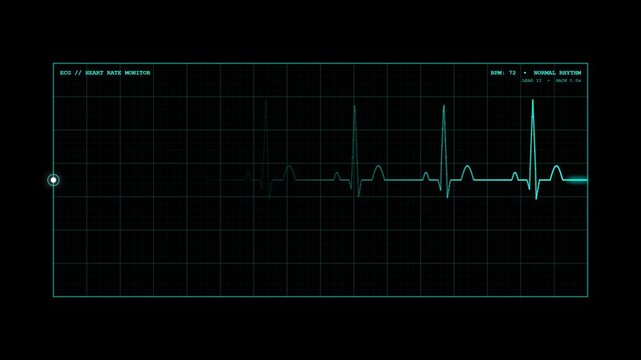 Digital ECG heart rate monitor screen showing normal heartbeat waveform