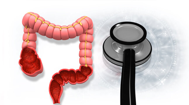 Anatomical human colon model and professional stethoscope for gastroenterology diagnosis on medical blue background. 3d illustration