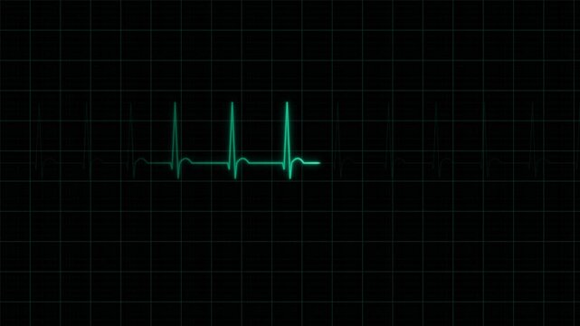 Digital Heartbeat Monitor Displaying Rhythmic EKG Pulse Waves on Dark Background.