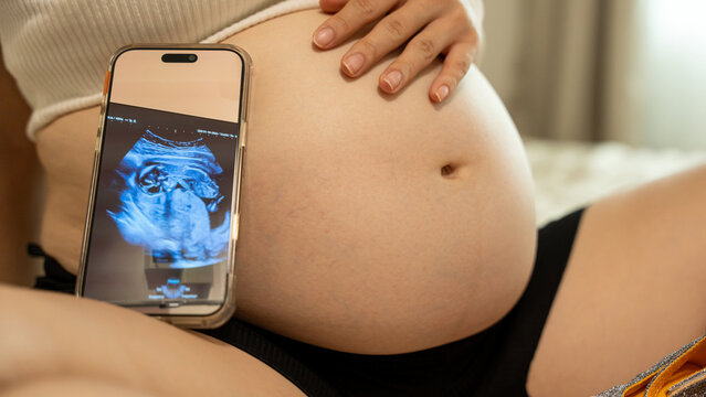 Close-up of a pregnant belly next to a smartphone displaying an ultrasound scan of the baby, held against the belly.