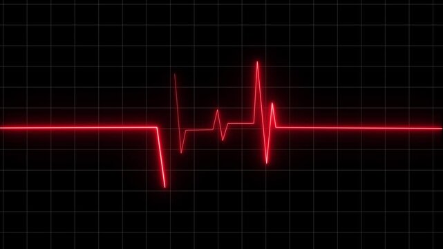 Red EKG pulse line moving across a black screen with grid lines during a medical emergency