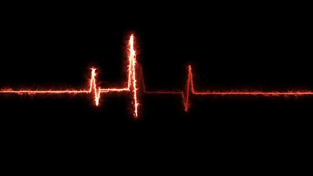 Electrocardiogram waveform pulsating in warm orange light against a dark background
