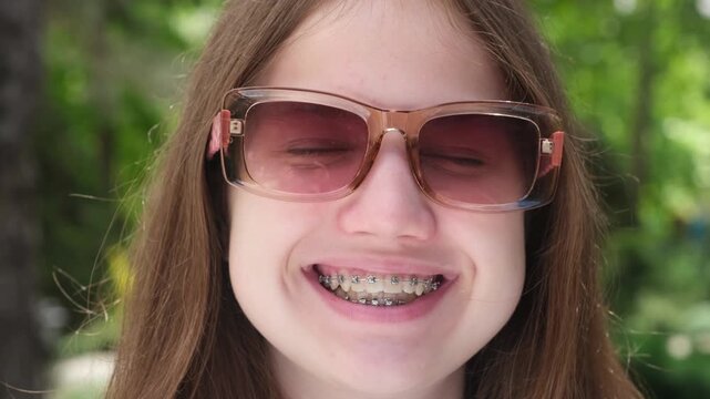 Close up face of caucasian happy teen girl with dental braces outdoors on sunny summer day. Female person in sunglasses smiling showing teeth with brackets